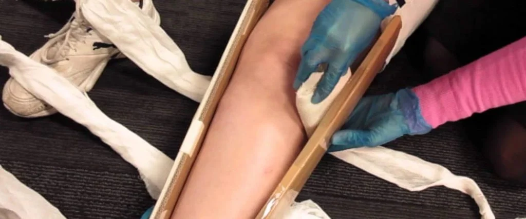 شکستگی های استخوان