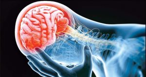 درمان فیزیو تراپی برای بیماران سکته مغزی (همی پارزی)