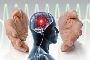 درمان فیزیو تراپی برای بیماران سکته مغزی