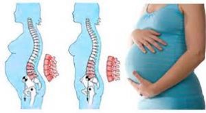 کمر درد های دوره بارداری و روش های مقابله با آن 
