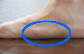 چرا کف پای برخی صاف است ؟ 