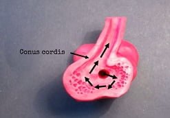 بهترین آموزش درباره عضله قلب conus cordis