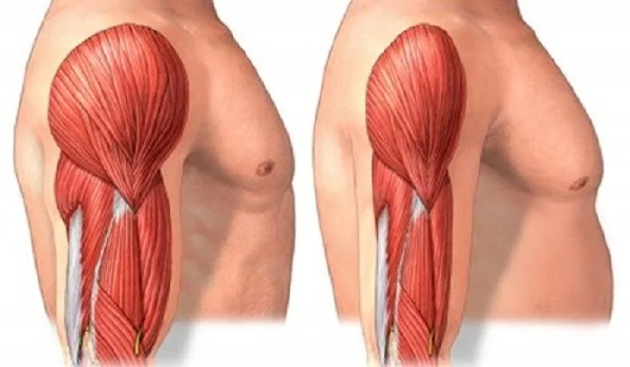 سخت ترین بیماری عضلانی