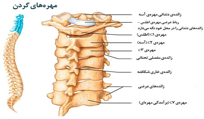مؤثرترین درمان گردن درد