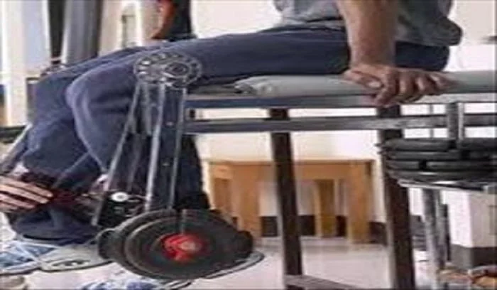 بهترین فیزیوتراپی برای بیماری لوپوس