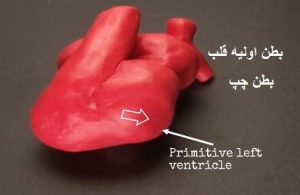 آموزش شکل گیری بطن چپ اولیه قلب