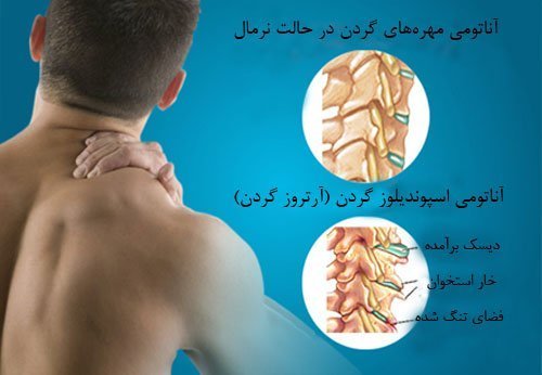 فیزیوتراپی برای گردن درد در کلینیک شایگان مهر