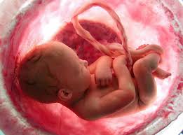  سقط جنین 