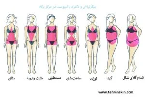 لیپوست جدیدترین روش لاغری