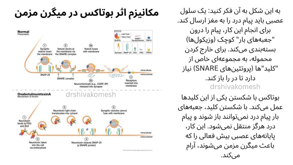بوتاکس,تزریق بوتاکس برای دیستونی,درمان دیستونی با بوتاکس,تزریق بوتاکس برای لرزش دست,متخصص تزریق بوتاکس برای اسپاسم عضلانی,تزریق بوتاکس زیر نظر متخصص مغز و اعصاب,بهترین متخصص بوتاکس درمانی برای بیماری‌های حرکتی,درمان انقباض غیرارادی عضلات,درمان کجی گردن (تورتیکولی),درمان پلک زدن غیرارادی (بلفارواسپاسم),درمان قفل شدن فک,درمان لرزش سر و دست,درمان گرفتگی عضلات نویسندگان,کاهش تعریق بیش از حد (هایپرهایدروز),درمان میگرن مزمن با بوتاکس,تزریق بوتاکس دقیق و تخصصی