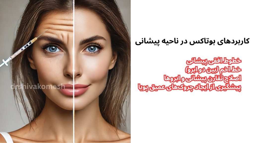 کاربرد بوتاکس