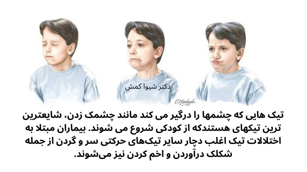 تیکهای عصبی تیک عصبی